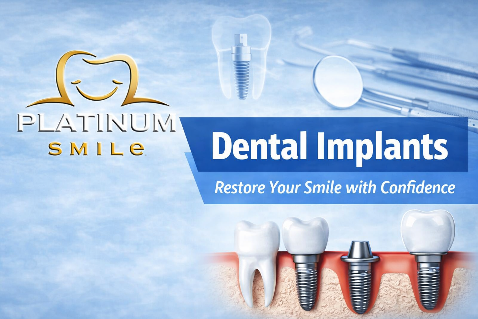 Dental Implants in Hadapsar